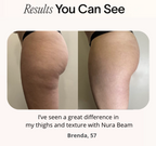 NuraSculpt™ Calves Wrap