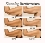 NuraSculpt™ Arm Band