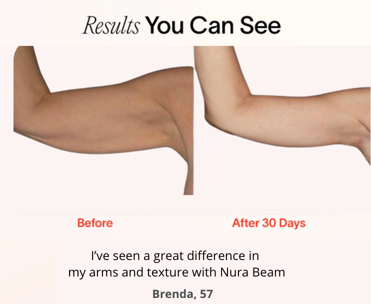 NuraSculpt™ Arm Band_